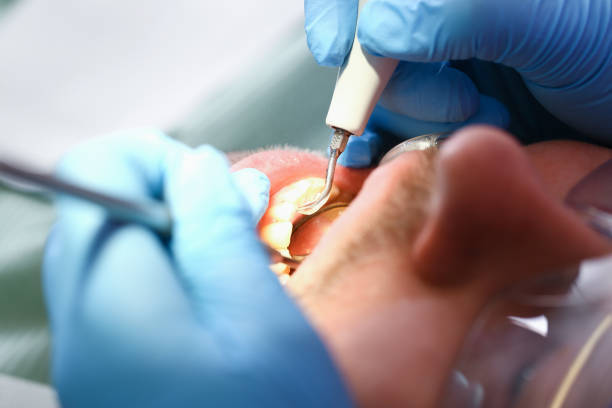 Best Chipped Tooth Repair Near Me  in Lemmon Valley, NV