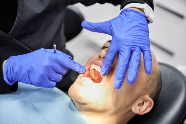 Teeth Whitening in NV